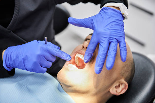 Best Emergency Wisdom Tooth Extraction in Burns, OR